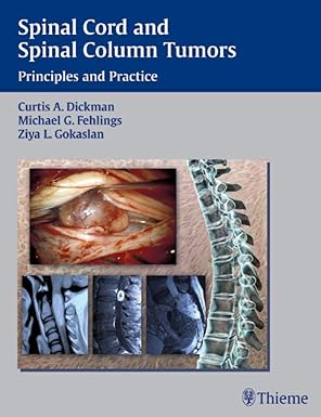 Principals and Practice: Spinal Cord and Spinal Column Tumors
