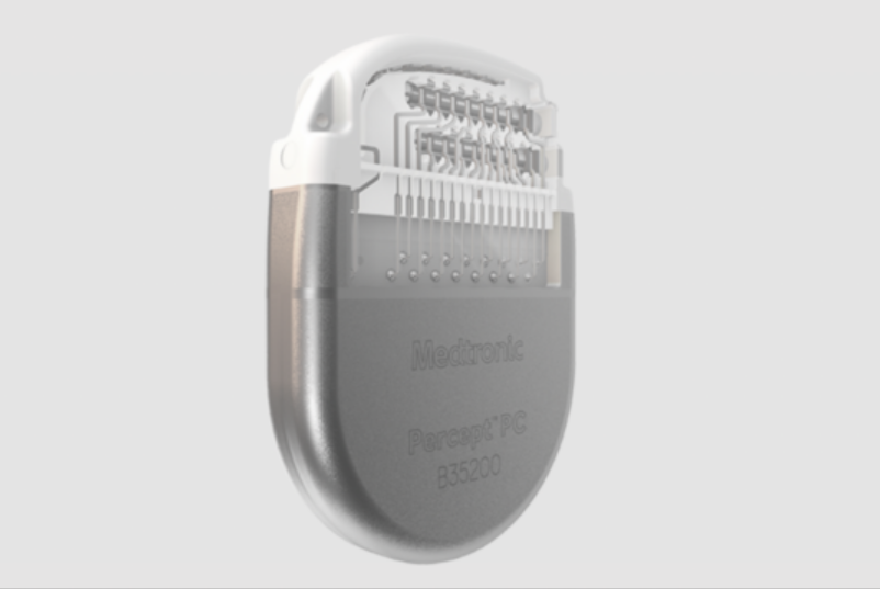 Deep Brain Stimulation